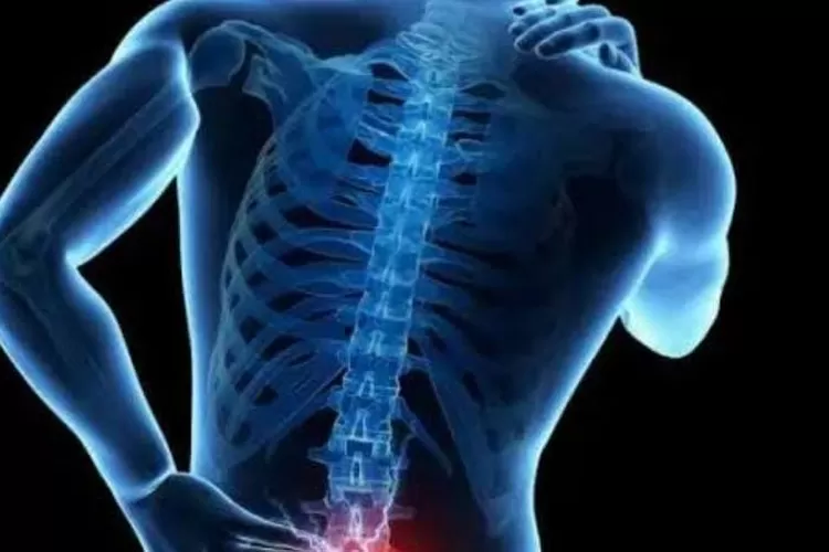 ilustrasi sakit pada tulang belakang