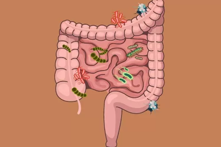 Usus Kamu Kotor Berikut Tanda Tanda Atau Ciri Ciri Jika Usus Kamu