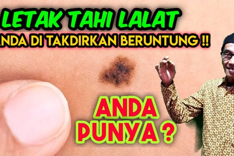 8 Letak Tahi Lalat Ini Ternyata Merupakan Tanda Pembawa Keberuntungan