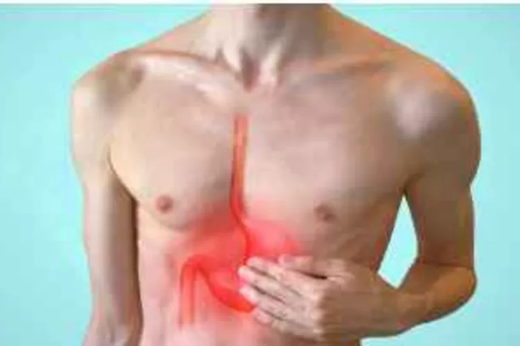 Gerd Gastroesophageal Reflux Disease Penyakit Asam Lambung Yang Memerlukan Perhatian Khusus