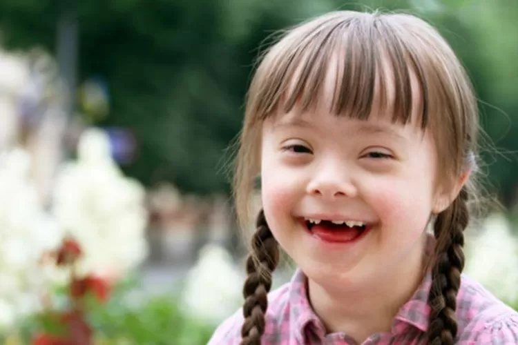 Hari Down Syndrome Sedunia, Ini 3 Fakta Soal "Down Syndrome" - Sinar ...