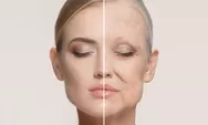 Masih Muda Udah Keriput? 6 Tips Kurangi sampai Hilangkan Garis Halus di Kulit