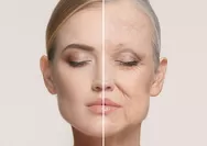 Masih Muda Udah Keriput? 6 Tips Kurangi sampai Hilangkan Garis Halus di Kulit