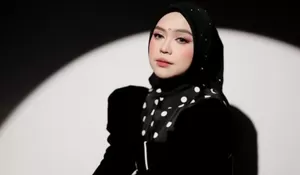 Ria Ricis Akui Oplas Hidung, Perubahan Penampilan Jadi Sorotan dan Viral di Media Sosial