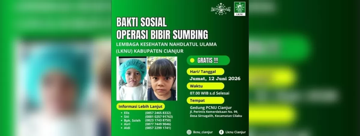 Bakti sosial operasi bibir sumbing gratis di Cianjur. (FOTO: Ist)