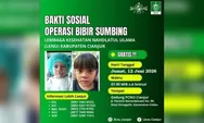 Bakti Sosial Operasi Bibir Sumbing Gratis di Cianjur