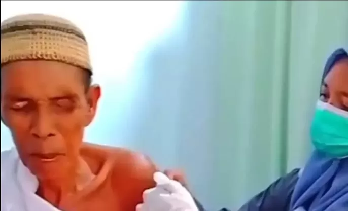 DIVAKSIN: Kai Gumbari, korban gigitan monyet liar di Aluh-Aluh harus mendapat vaksin rabies (POLSEK ALUH-ALUH) 