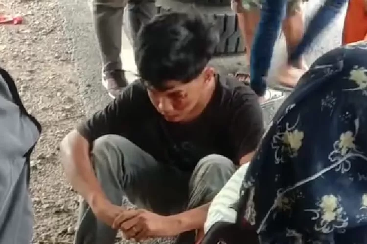 korban kecelakaan yang selamat dari lindasan truk di jalan di Deli Serdang