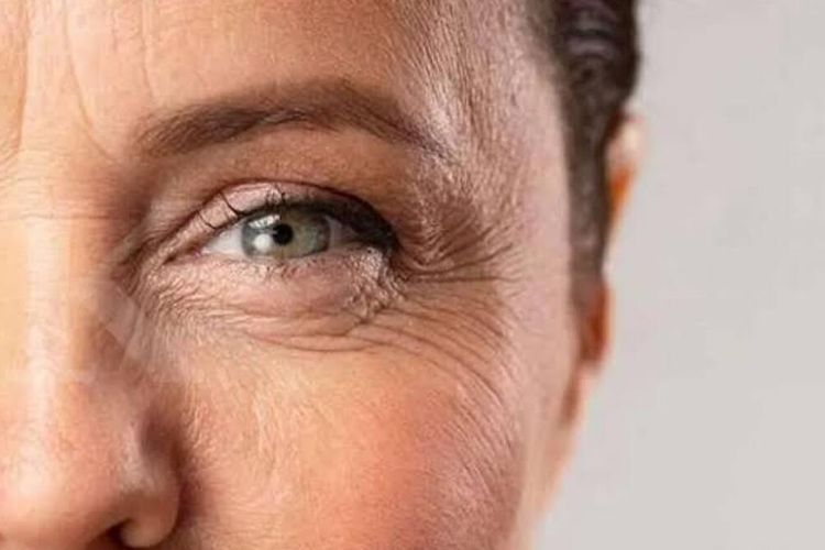 Kulit Keriput: Penyebab, Pencegahan, dan Perawatan