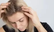 5 Cara Ampuh Membasmi Ketombe dengan Bahan Alami, Mudah dan Efektif!