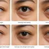 TIPS Kesehatan: Cara Menghilangkan Kantung Mata dengan Cepat, Alami, dan Aman