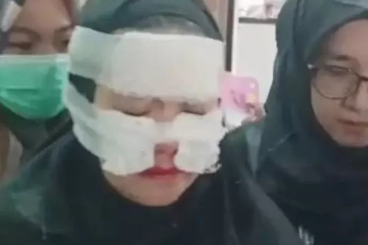 kondisi korban di Balon meledak di hari guru SDN Cimuning 1 Bekasi (Tangkapan layar)