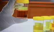 Urine Bau? Waspada! 9 Penyebab yang Mungkin Tak di Sangka
