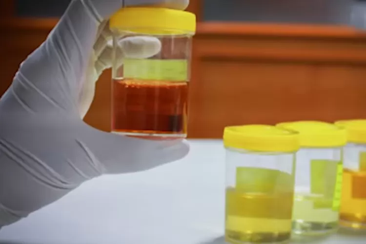 Foto Ilustrasi Kencing Manis dan Mengatasi Diabetes Menggunakan Akar Adem Ati (Tangkap Layar Channel YouTube SB30HEALTH)