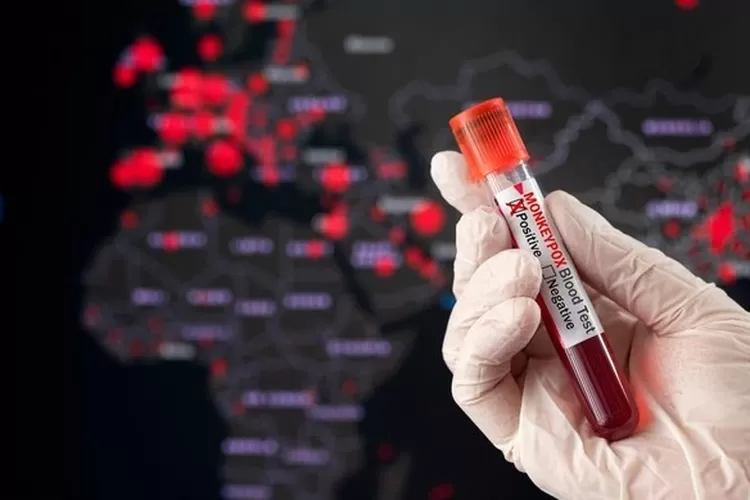 Ilustrasi. Ada dua warga Kota Bogor terjangkit virus cacar monyet atau mokey pox 