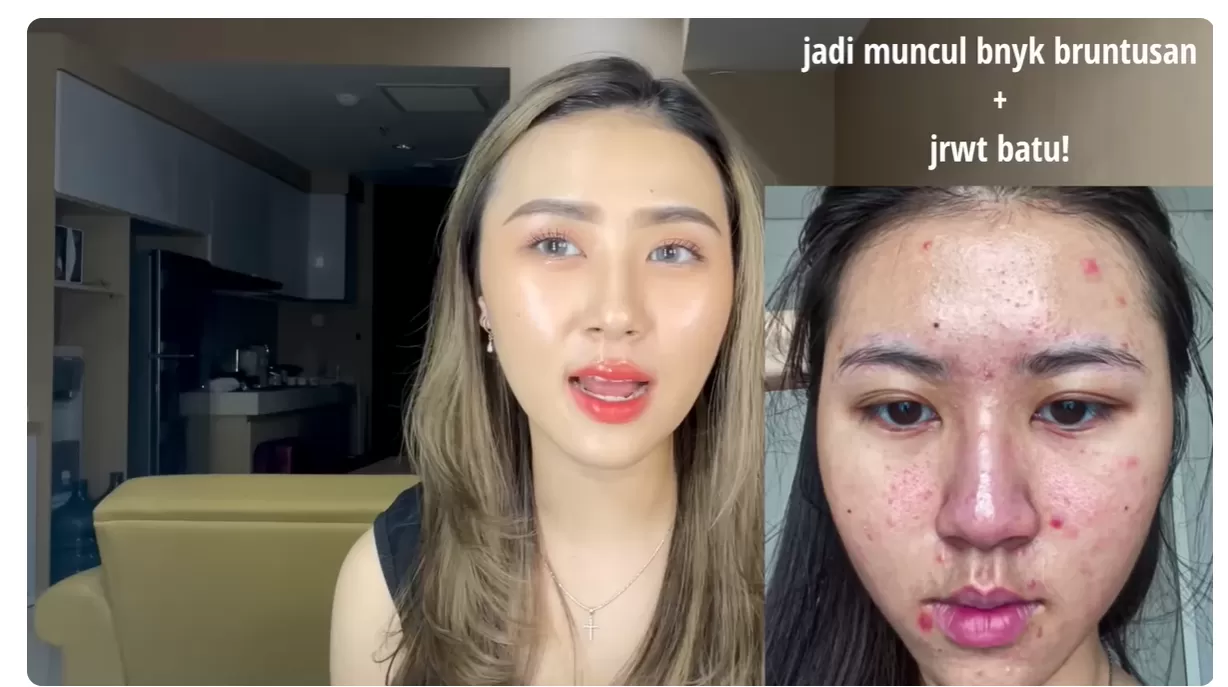 Tips Merawat Kulit Wajah Jadi Sehat Dan Glowing Dengan Produk Skincare ...