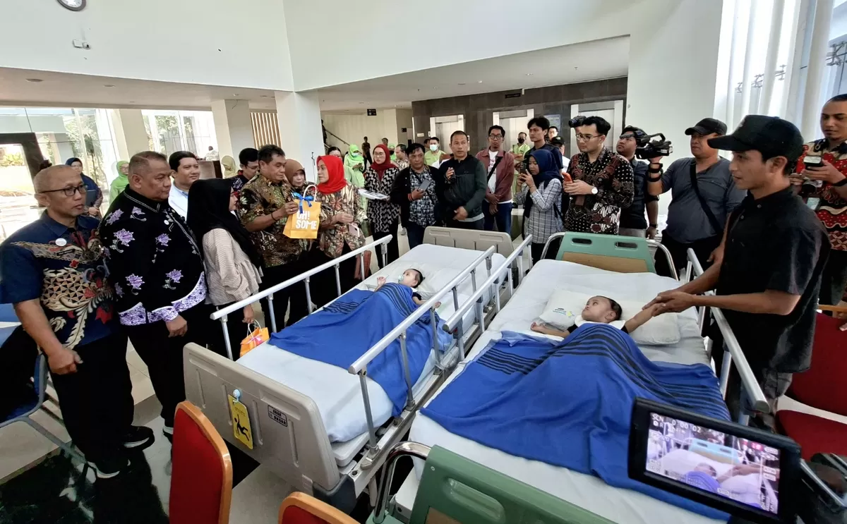 Setahun Menanti, Kembar Siam Shayna dan Shazia Akhirnya Berhasil Dipisahkan RS Kariadi 