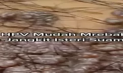 Viral di Tiktok: Anak Perempuan Umur 14 Tahun Sulit Berjalan Karena Kena Condyloma Acuminata, Sudah Hubungan Dengan Pacar Dari Lulus SD!