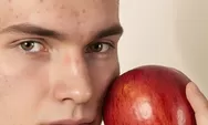 Cuka Apel Bisa Bantu Atasi Jerawat, Begini Cara Pakainya