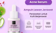 5 Rekomendasi Serum untuk Acne Prone Mulai dari Brand Lokal hingga Internasional, Jerawat Auto Hempas